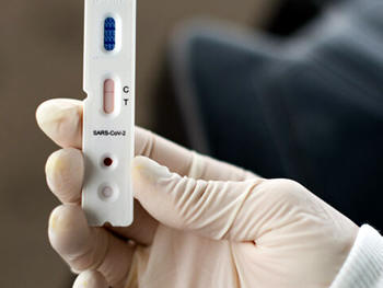 Aquisição de até 50 mil testes rápidos para detecção do coronavírus - Imagem ilustrativa